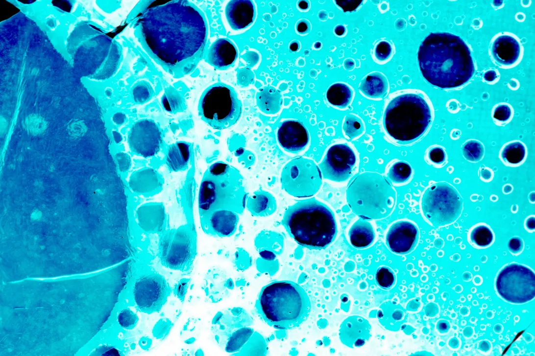 2026 June 02 - Weekly Sidebar - Close Call - Cancer Cell